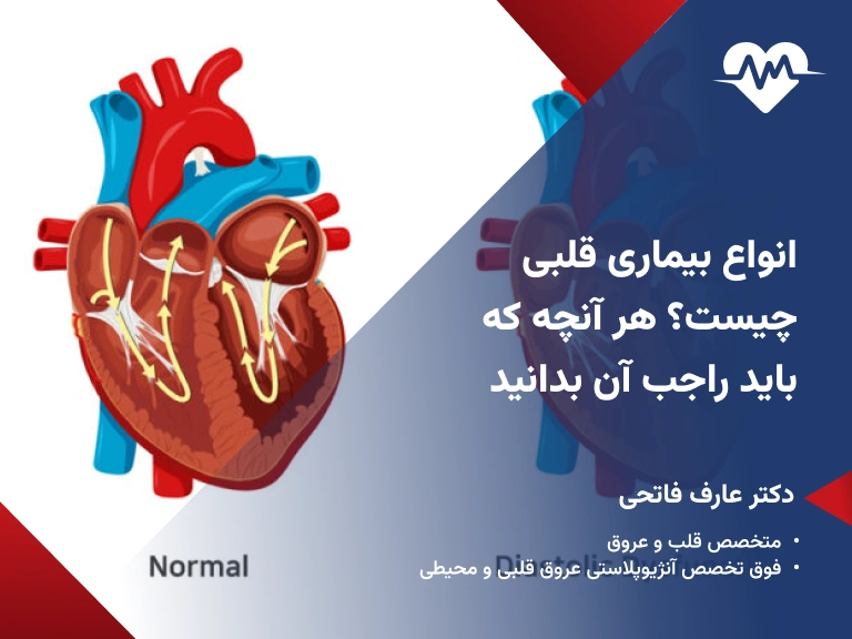 انواع بیماری قلبی
