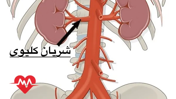 آنژیوگرافی کلیه