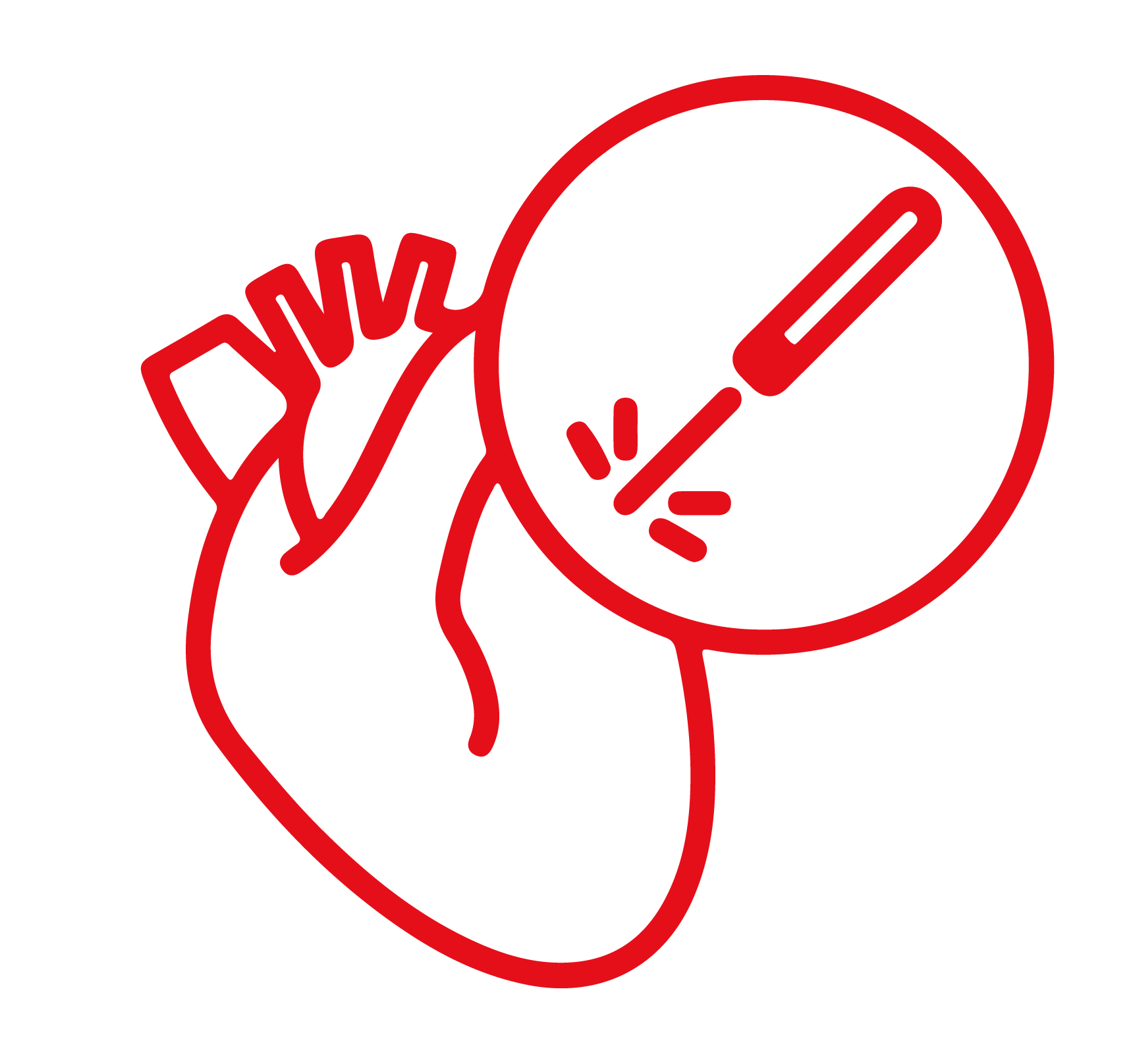 آنژیوگرافی