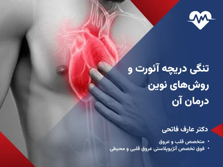 تنگی دریچه آئورت