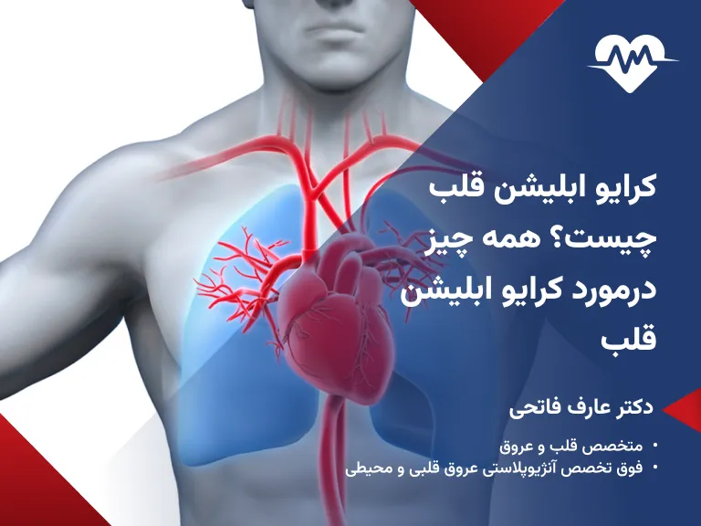 کرایو ابلیشن قلب