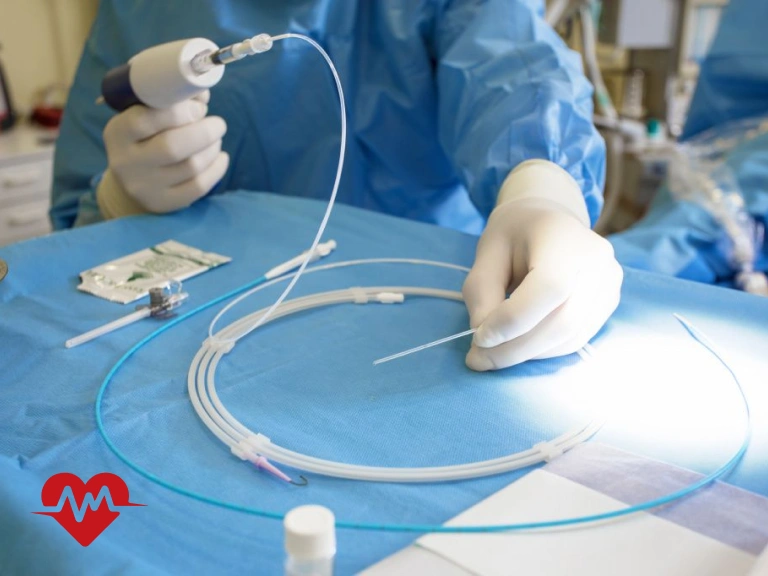 آنژیوپلاستی