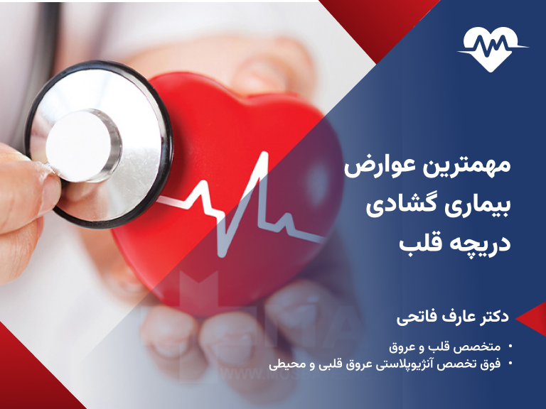 گشادی دریچه قلب