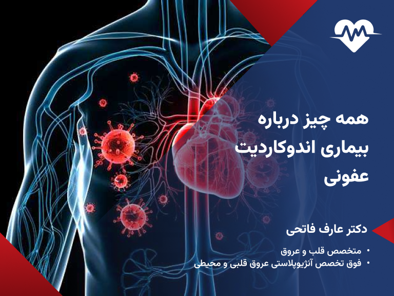 اندوکاردیت