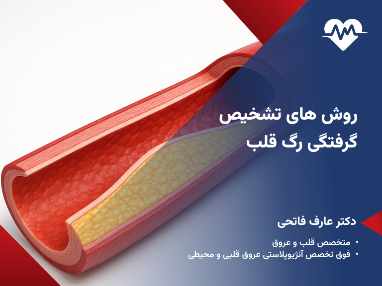 گرفتگی رگ قلب