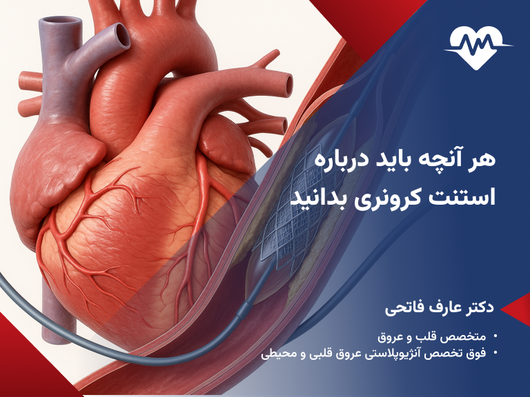 استنت کرونری