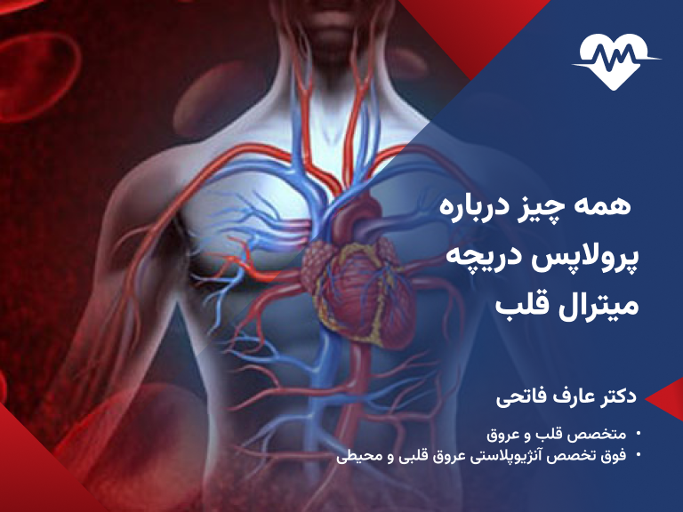 پرولاپس دریچه میترال