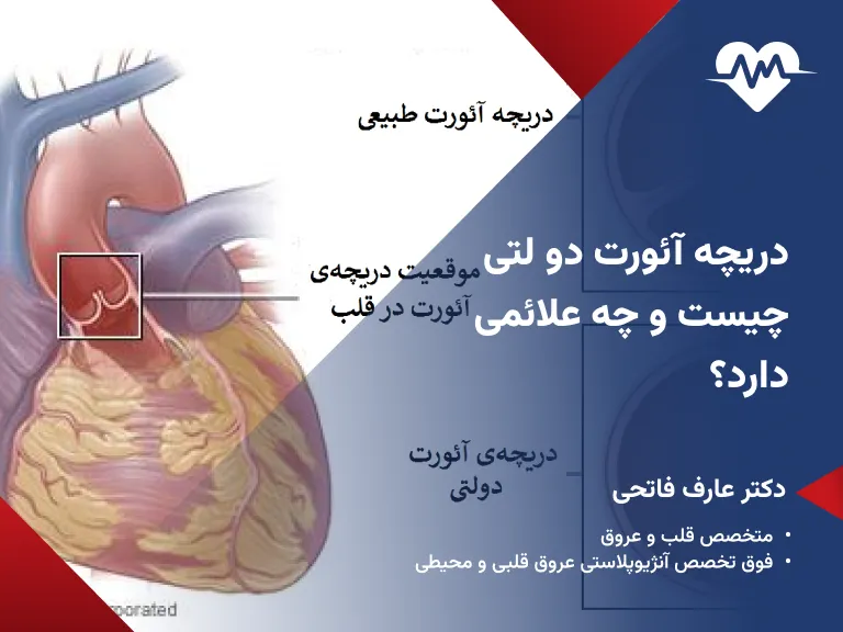 دریچه آئورت دو لتی