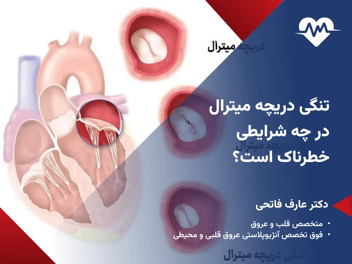 ایا تنگی دریچه میترال خطرناک است