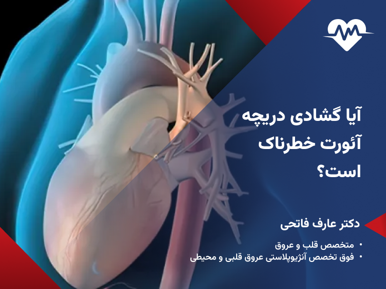 ایا گشادی دریچه آئورت قلب خطرناک است