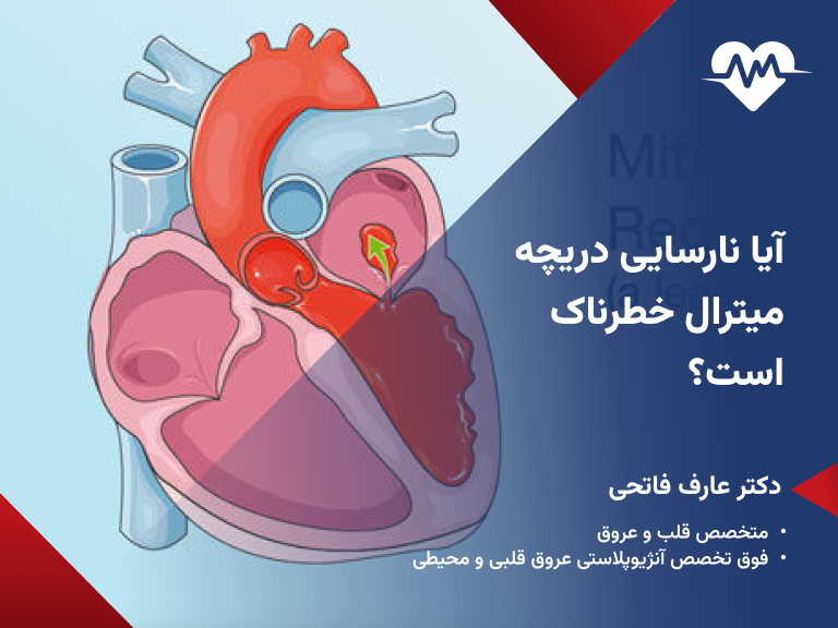 ایا نارسایی دریچه میترال خطرناک است
