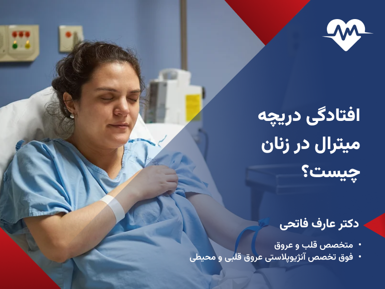 افتادگی دریچه میترال در خانم ها