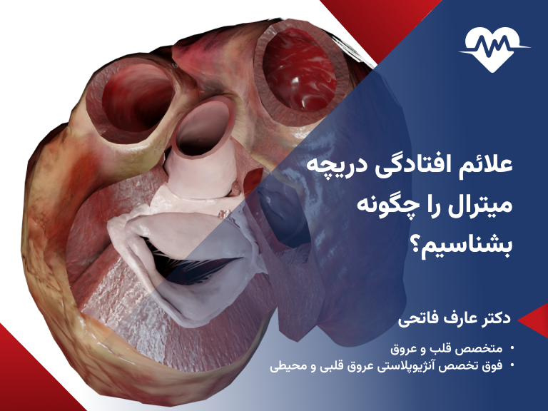 علائم افتادگی دریچه میترال