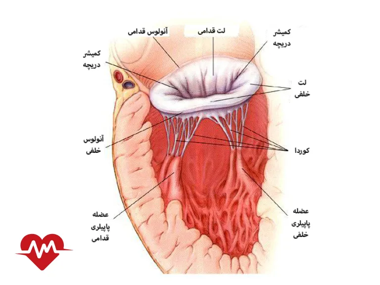نرمی دریچه میترال قلب