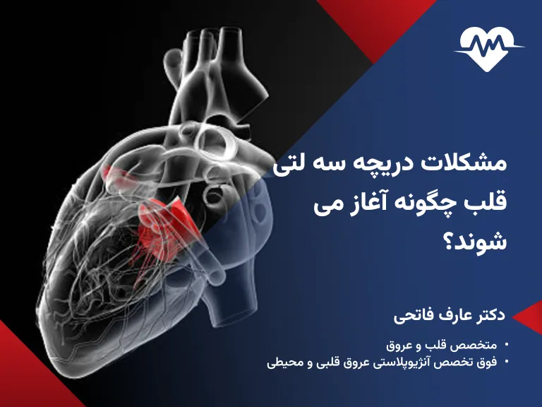 دریچه سه لتی