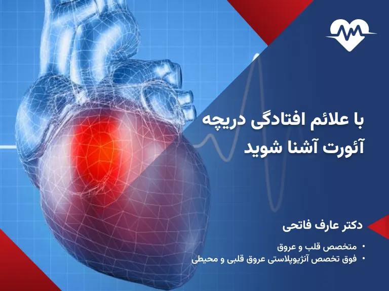 افتادگی دریچه آئورت