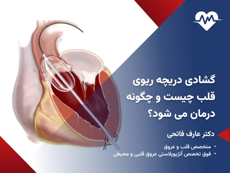 گشادی دریچه ریوی قلب چیست و چگونه درمان می شود؟