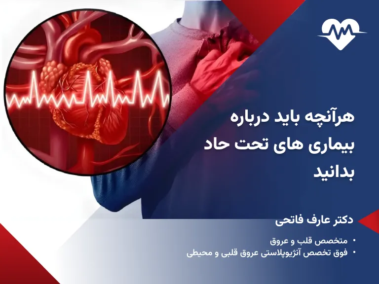 بیماری تحت حاد یعنی چه