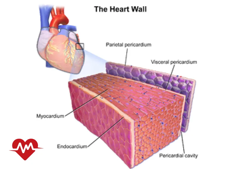 آندوکارد قلب