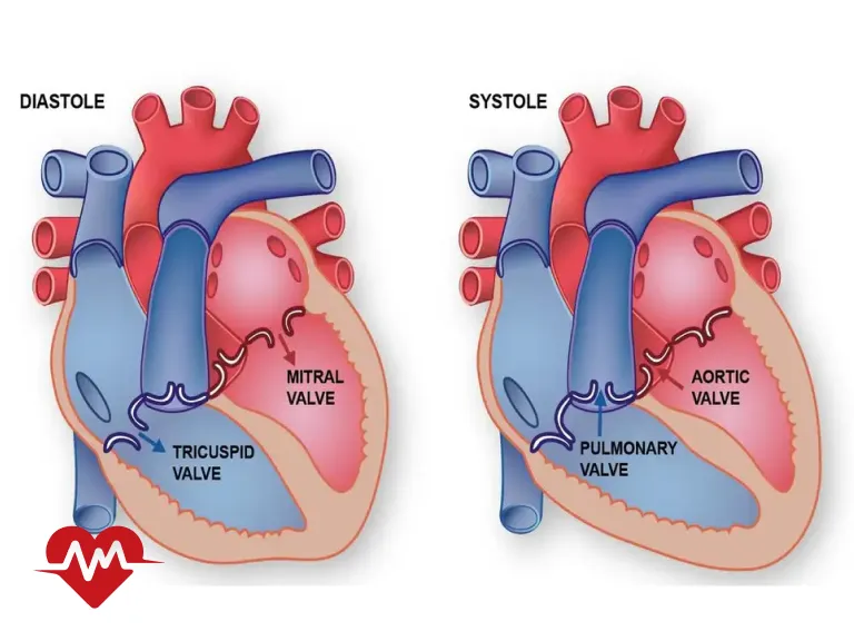 ترمیم دریچه میترال قلب بدون جراحی
