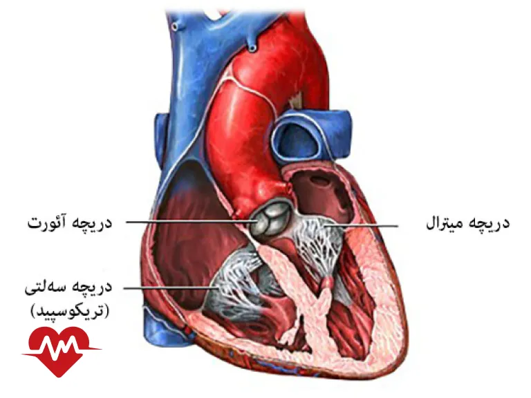 نارسایی دریچه قلب