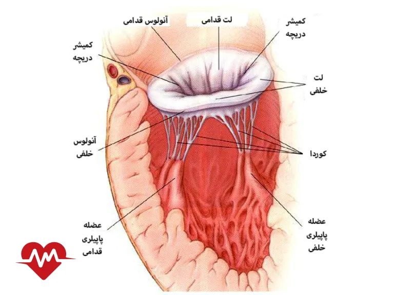 نارسایی دریچه قلب
