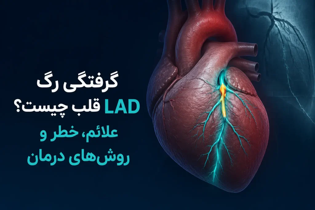 گرفتگی رگ LAD قلب