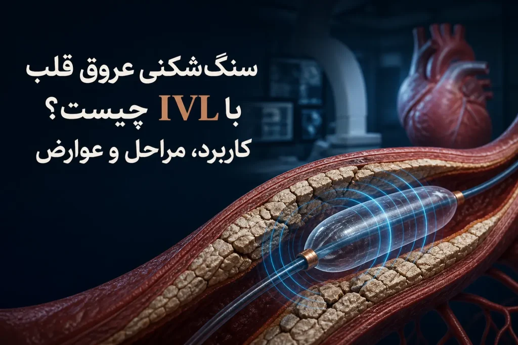 سنگ‌شکنی عروق قلب با IVL