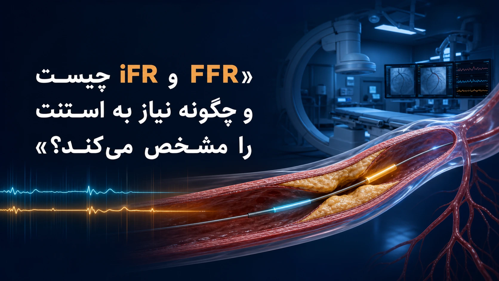 FFR و iFR چیست؟