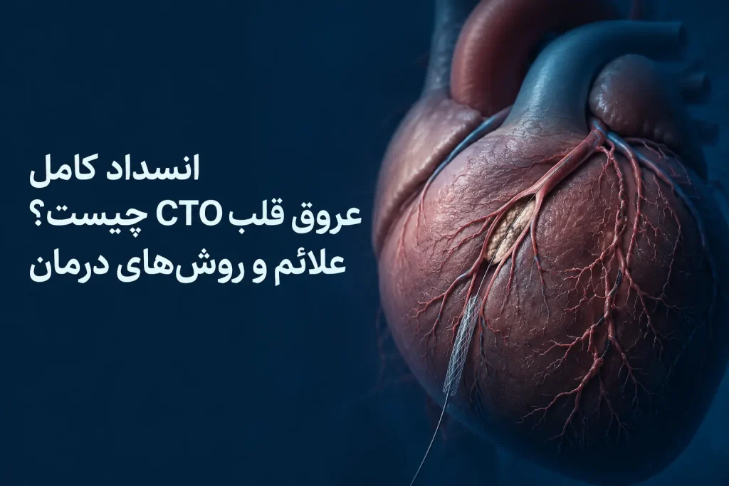 انسداد کامل عروق قلب