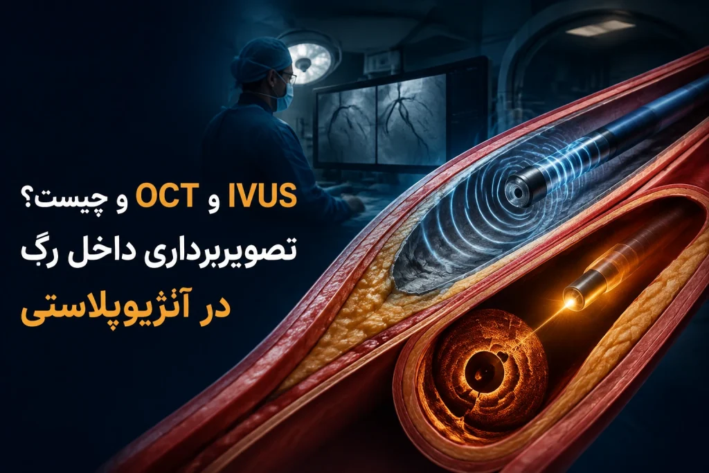 IVUS و OCT چیست؟